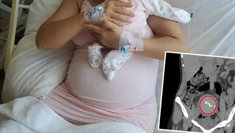Doğumda Unutulduğu İddia Edilen Bebek, İki Yıl Sonra Ortaya Çıktı: Gazlı Bez İhmaline Soruşturma