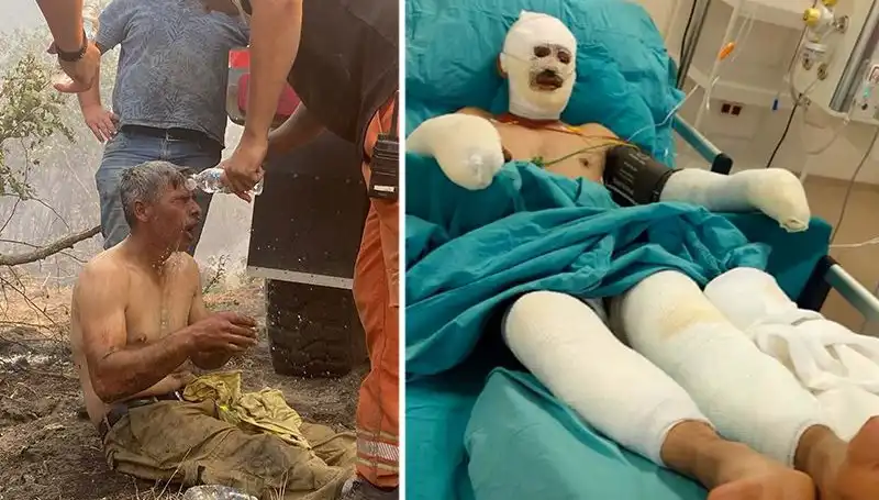 Orman İşçisinin Yangın İhbarı: "Yanıyorum" Feryadı Gündemi Sarstı