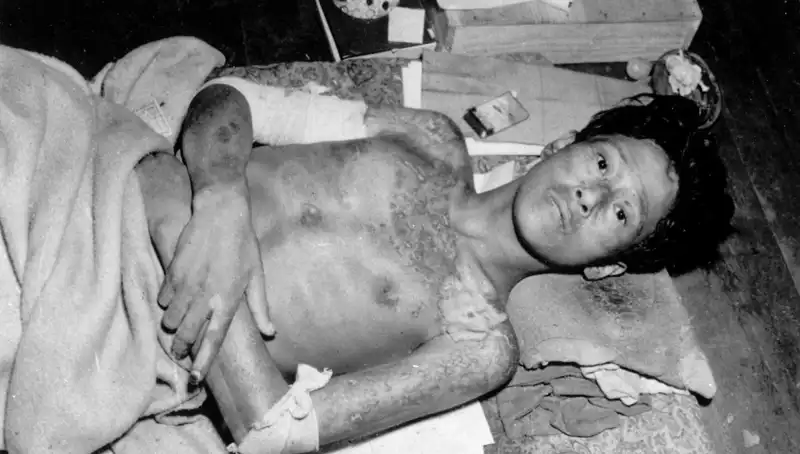 80 Yıl Sonra Nagasaki’den Tüm Dünyaya Nükleer Felaket Uyarısı