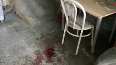 Sandalyeden Düşen Adamın Yaralanma Sebepleri ve Sonuçları