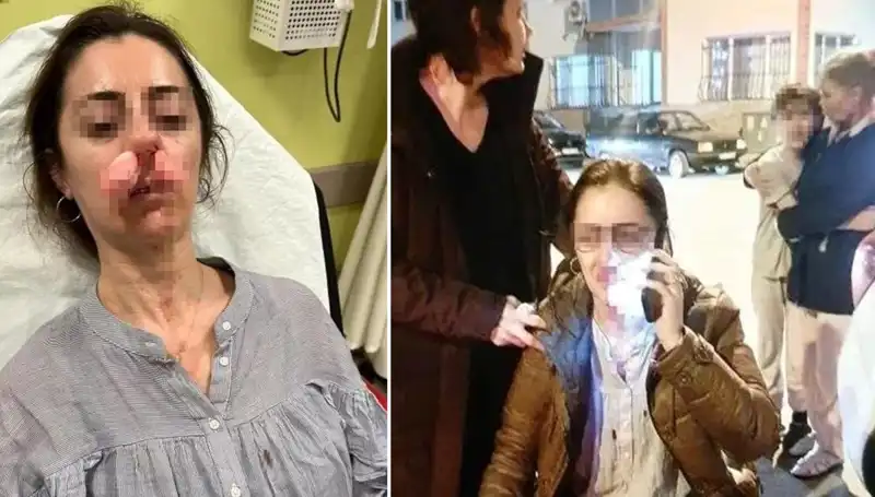 Eşinin Sevgilisi Sandığı Otomobil Kapısıyla Saldırdı: Olayın Perde Arkası Açığa Çıkıyor